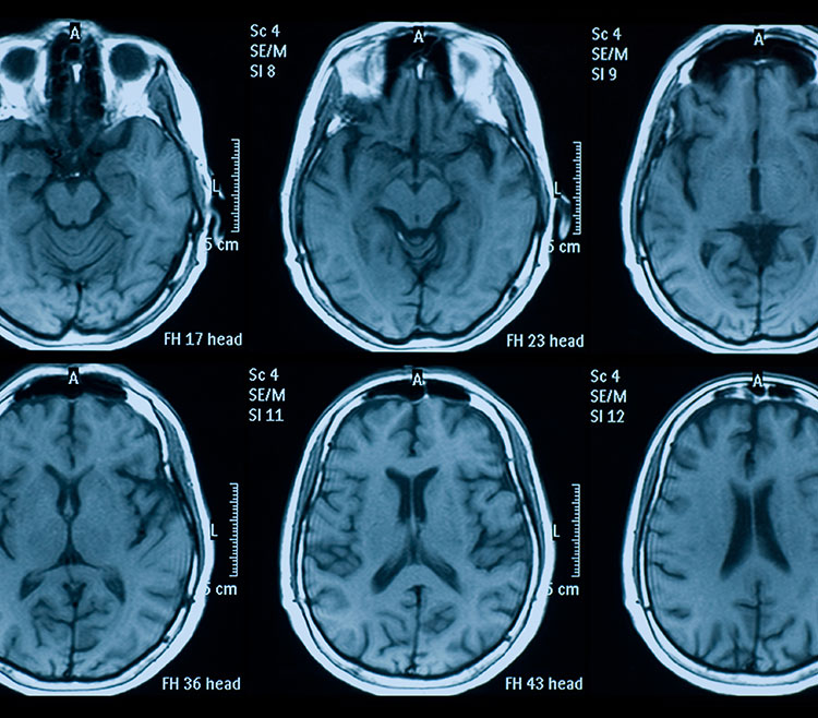 Magnetic Resonance Imaging Technologist